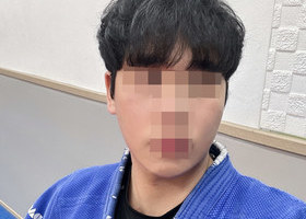 일퍼센트 윤곽 삼종 한달 후기입니다(하이3D광대축소술+