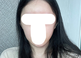 윤곽삼종 한달 후기올려봅니다~
