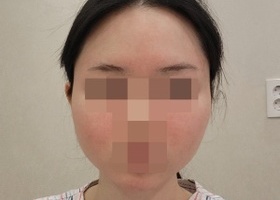 윤곽 고민하시면 여기 추천해요 정말루..