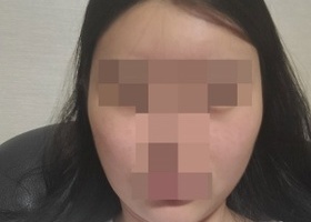 얼굴형이 이뻐지니 다른곳도 다 예뻐보이네용!ㅋㄷ