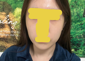 사각턱 2종 4개월 됐어요