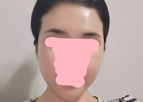 사후관리까지 채고~~~