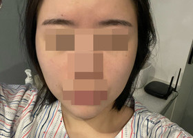 광대 후기입니당~~ㅎㅎ