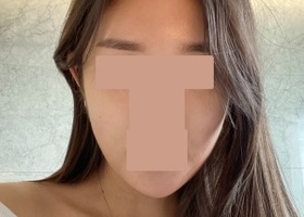 예전에는 길어보이는 턱끝 비대칭 때문에 인상이 쎄보였는