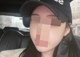 윤곽1종 광대후기 최선을다해 수술해주시겠다는말이 너무 