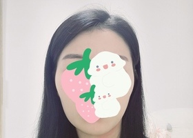 하루하루 다르게 붓기가 빠지고 있어요'ㅁ'