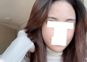 상담이 정말 친절하고 꼼꼼했단 걸 느끼고 내가 수술할 