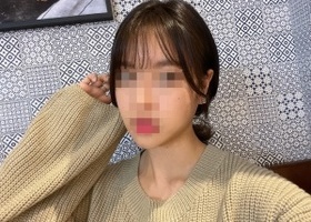 [광대 사각턱 2종] 벌써 이정도면 나중에 얼굴이 심각