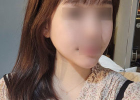 안면윤곽은 역시 일퍼센트~