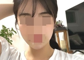 너무 인형라인으로 해버리면 중안부만 길고 얼굴형만 이뻐