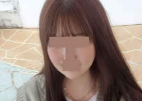 턱끝재수술, 비스포크V라인