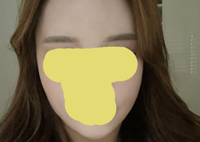 인형라인으로 개선됐어요