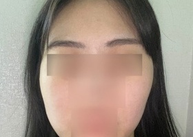다른 병원은 알아보지도 않고 친구 전후 x-ray랑 결