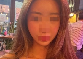 거울볼때마다 턱라인에 놀랍니다!ㅎ