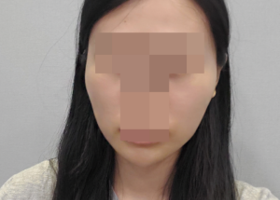 일퍼센트는 수술 후 cctv영상을 처음부터 끝까지 원장