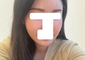 사각턱 앞턱 피질절골 윤곽했어요 최근에 얼굴이 작아졌다