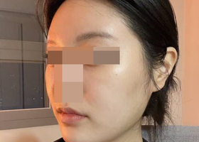 윤곽은 일퍼에서 하세용!