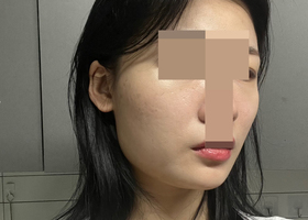 윤곽 3종 4개월 후기임돠