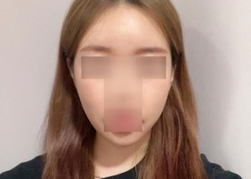 윤곽+지이+지흡 한지 이제 두달 조금 넘었어요!