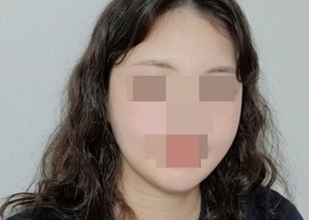 얼굴도 작아지고 라인도 원하는 모양으로 만족스럽게 잘 