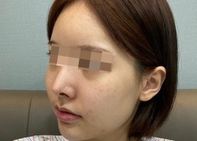 윤곽4개월차 얼굴형 뿐인데 얼굴형 하나 바뀌었다고 분위