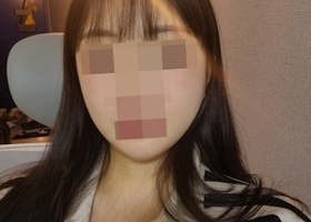 3종 4개월차! 계속 얼굴이 작아지고 있어요