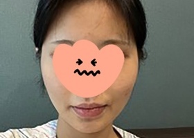 갸름해진 예쁜 얼굴이 넘 조앙>