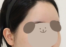 광대 사각턱 턱끝 다 끝장봤습니당~~