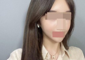 지금은 밥도 잘먹고 입도 잘 벌어지고 윤곽한거 모르고 