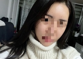원장님이 붓기 심하다구 빠지면 얼굴 더 작아질거라고 하