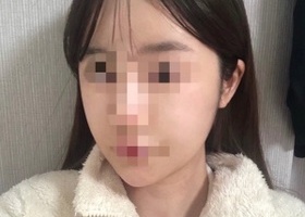 광대부분 이 확 슬림 해져서 너무 만족 중!!