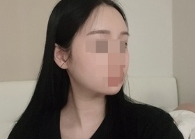 지금은 확실히 얼굴이 많이 작아진 것이 보이고 턱이 생