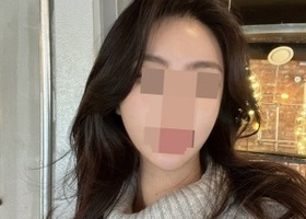 광대 1종 수술 후 4일차부터 출근했어요 ㅎㅎ
